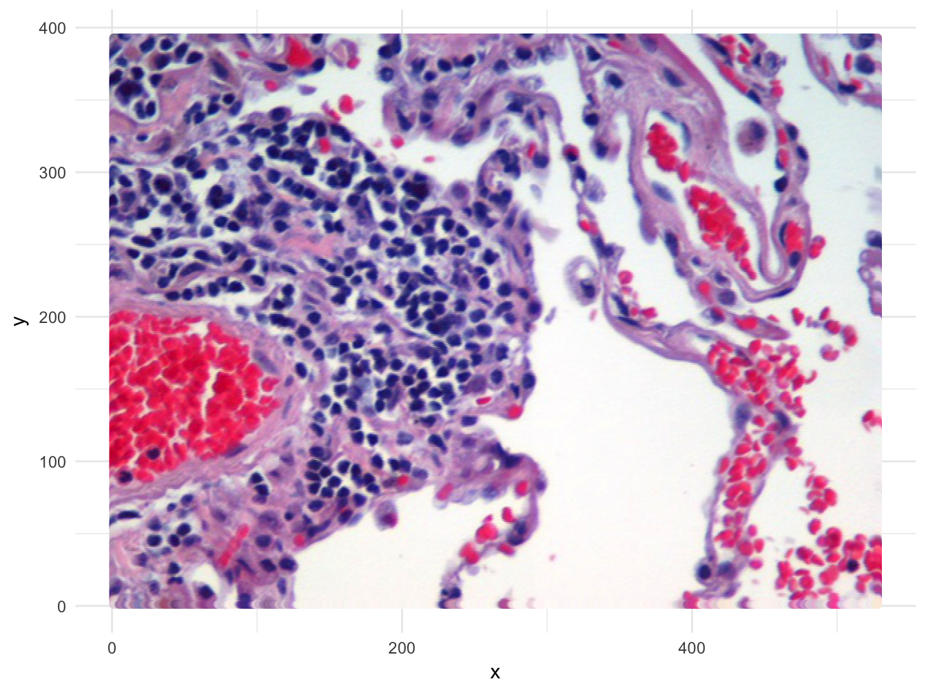Image of lung tissue recreated from reshaped data.