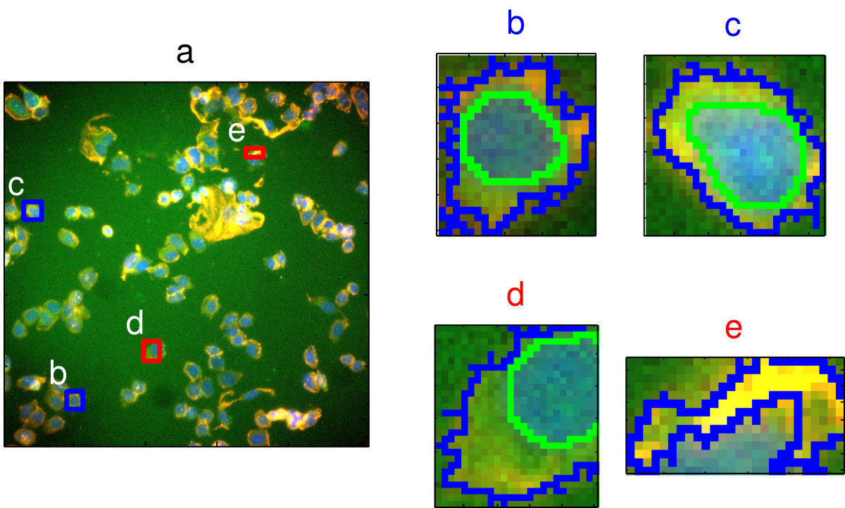 Image segmentation in high content screening. Images **b** and **c** are examples of well-segmented cells; **d** and **e** show poor-segmentation. Source: Hill(2007) https://doi.org/10.1186/1471-2105-8-340
