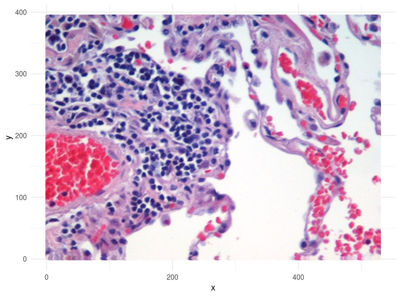 Image of lung tissue recreated from reshaped data.